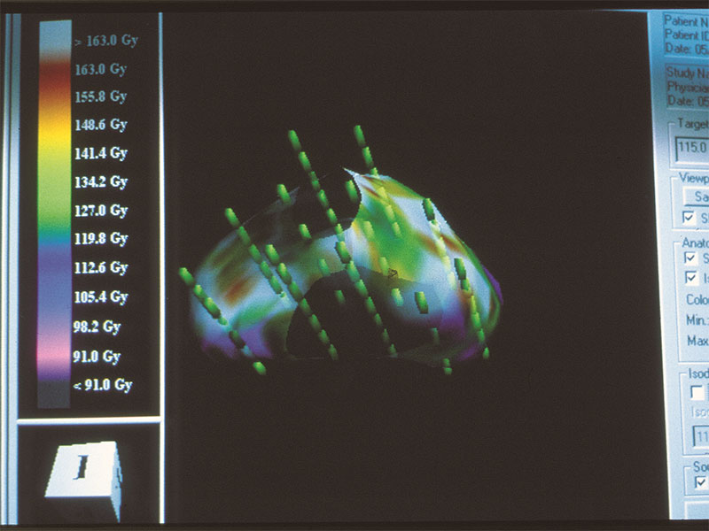 Seed implant treatment center in Rancho Mirage, CA